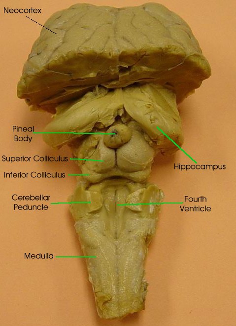 sheep brain sagittal view